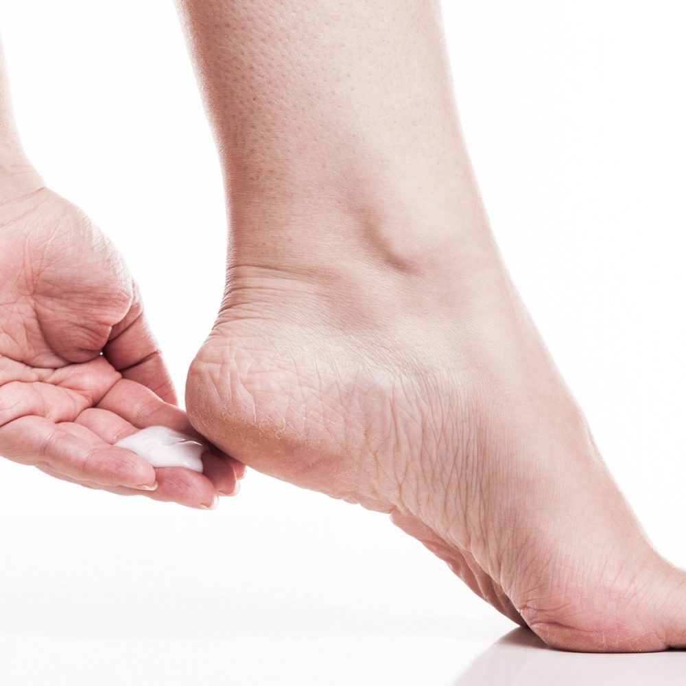 Dry skin on feet how to get rid of dry skin on feet