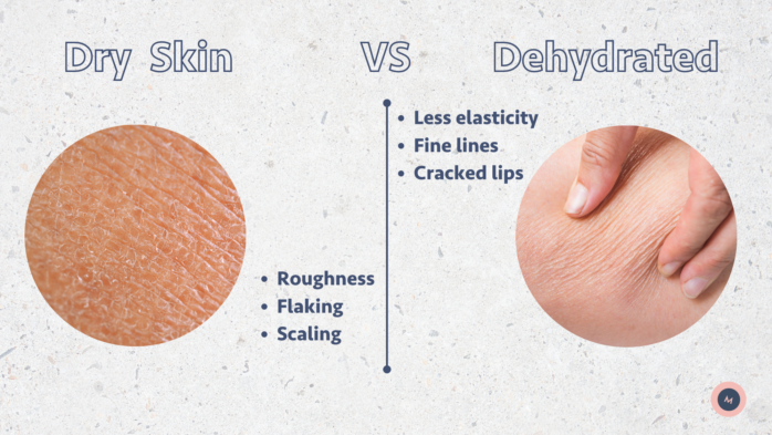 Signs of dehydrated skin vs dry skin