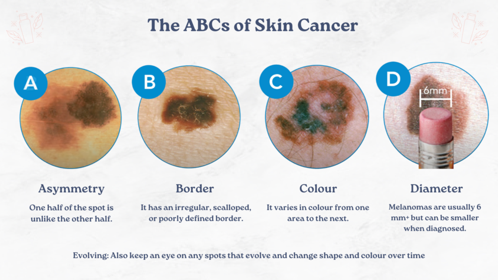 What does skin cancer look like and what skin cancer symptoms to look out for